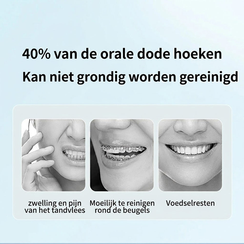 Grachtdal Draagbare Waterflosser - Professionele Mondverzorging